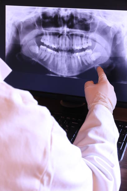Best Broken or Chipped Tooth Repair in Hillside Lake, NY